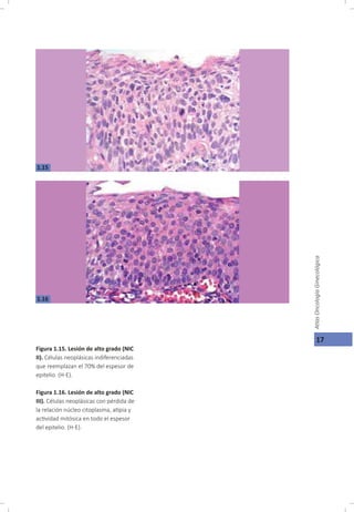 Oncología Ginecológica, Capitulo 1