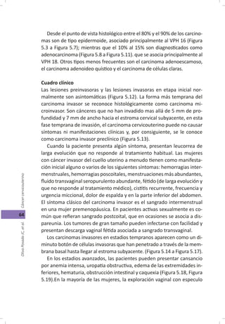 Cáncer cérvicouterino