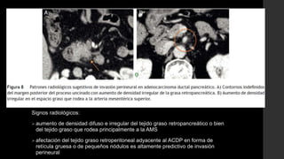 Signos radiológicos:
 aumento de densidad difuso e irregular del tejido graso retropancreático o bien
del tejido graso que rodea principalmente a la AMS
 afectación del tejido graso retroperitoneal adyacente al ACDP en forma de
retícula gruesa o de pequeños nódulos es altamente predictivo de invasión
perineural
 