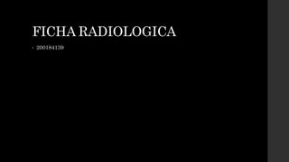 FICHA RADIOLOGICA
• 200184139
 