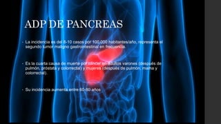 ADP DE PANCREAS
• La incidencia es del 8-10 casos por 100.000 habitantes/año, representa el
segundo tumor maligno gastrointestinal en frecuencia.
• Es la cuarta causa de muerte por cáncer en adultos varones (después de
pulmón, próstata y colorrectal) y mujeres (después de pulmón, mama y
colorrectal).
• Su incidencia aumenta entre 60-80 años
 