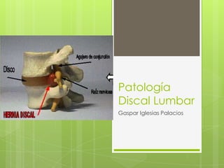 Patología
Discal Lumbar
Gaspar Iglesias Palacios
 