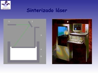 Sinterizado láser
 