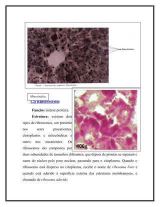 1.2) RIBOSSOMO1.2) RIBOSSOMO
Função: síntese protéica.
Estrutura: existem dois
tipos de ribossomos, um presente
nos seres procariontes,
cloroplastos e mitocôndrias e
outro nos eucariontes. Os
ribossomos são compostos por
duas subunidades de tamanhos diferentes, que depois de prontas se separam e
saem do núcleo pelo poro nuclear, passando para o citoplasma. Quando o
ribossomo está disperso no citoplasma, recebe o nome de ribosoma livre e
quando está aderido à superfície externa das estruturas membranosas, é
chamado de ribosoma aderido.
Mitocôndria
 