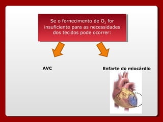 Se o fornecimento de O 2  for insuficiente para as necessidades dos tecidos pode ocorrer: Enfarte do miocárdio AVC 