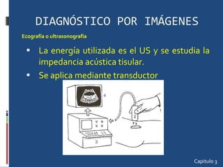 DIAGNÓSTICO POR IMÁGENES La energía utilizada es el US y se estudia la impedancia acústica tisular. Se aplica mediante transductor Capitulo 3 Ecografía o ultrasonografía 