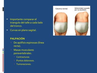 Importante comparar el triangulo del talle a cada lado del tronco. Curvas en plano sagital. PALPACIÓN De apófisis espinosas (línea recta). Masas musculares paravertebrales. Contracturas Puntos dolorosos. Tumoraciones. 
