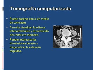 Tomografía computarizada Puede hacerse con o sin medio de contraste. Permite visualizar los discos intervertebrales y el contenido del conducto raquídeo. Pueden evaluarse las dimensiones de este y diagnosticar la estenosis raquídea. 