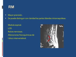 RM Mayor precisión. Se puede distinguir con claridad las partes blandas intrarraquídeas: Medula espinal. LCR. Raíces nerviosas. Alteraciones fisicoquímicas de l disco intervertebral. 
