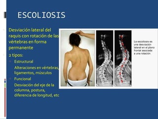ESCOLIOSIS Desviación lateral del raquis con rotación de las vértebras en forma permanente 2 tipos: Estructural Alteraciones en vértebras, ligamentos, músculos Funcional Desviación del eje de la columna, postura, diferencia de longitud, etc 