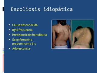 Escoliosis idiopática Causa desconocida 85% frecuencia Predisposición hereditaria Sexo femenino predominante 6:1 Adolescencia  