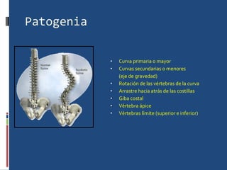 Patogenia Curva primaria o mayor Curvas secundarias o menores (eje de gravedad) Rotación de las vértebras de la curva Arrastre hacia atrás de las costillas Giba costal Vértebra ápice Vértebras límite (superior e inferior) 