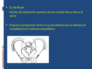 Sx de Risser  Núcleo de osificación aparece de las crestas íliacas hacia el sacro Evaluar la progresión de la curva escoliótica que se detiene al completarse la madurez esquelética 