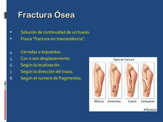 Fractura Ósea Solución de continuidad de un hueso. Fisura “fractura sin trascendencia”. Cerradas o expuestas. Con o son desplazamiento Según la localización. Según la dirección del trazo. Según el numero de fragmentos. 