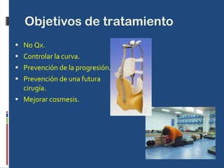Objetivos de tratamiento No Qx. Controlar la curva. Prevención de la progresión. Prevención de una futura cirugía. Mejorar cosmesis. 