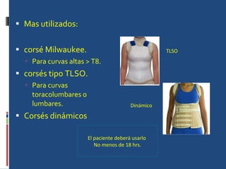 Mas utilizados: corsé Milwaukee. Para curvas altas > T8. corsés tipo TLSO. Para curvas toracolumbares o lumbares. Corsés dinámicos El paciente deberá usarlo  No menos de 18 hrs. TLSO Dinámico 