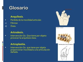 Glosario Anquilosis . Perdida de la movilidad articular. Fibrosa Ósea. Artrodesis. Intervención Qx. Que tiene por objeto provocar la anquilosis ósea. Artroplastia. Intervención Qx. que tiene por objeto proporcionar movilidad a una articulación dañada. 
