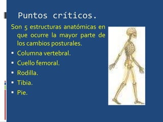 Puntos críticos. Son 5 estructuras anatómicas en que ocurre la mayor parte de los cambios posturales. Columna vertebral. Cuello femoral. Rodilla. Tibia. Pie. 