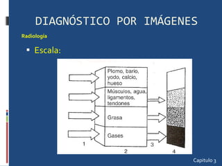 DIAGNÓSTICO POR IMÁGENES Escala: Capitulo 3 Radiología  