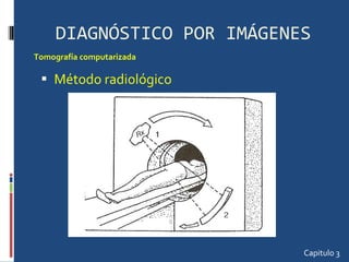 DIAGNÓSTICO POR IMÁGENES Método radiológico  Capitulo 3 Tomografía computarizada  