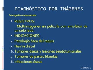 DIAGNÓSTICO POR IMÁGENES REGISTROS: Multiimagenes en pelicula con emulsion de un solo lado.  INDICACIONES: Patología ósea del raquis Hernia discal Tumores óseos y lesiones seudotumorales Tumores de partes blandas Infecciones óseas Capitulo 3 Tomografía computarizada  