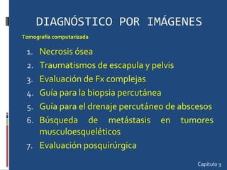 DIAGNÓSTICO POR IMÁGENES Necrosis ósea Traumatismos de escapula y pelvis Evaluación de Fx complejas Guía para la biopsia percutánea Guía para el drenaje percutáneo de abscesos Búsqueda de metástasis en tumores musculoesqueléticos Evaluación posquirúrgica  Capitulo 3 Tomografía computarizada  
