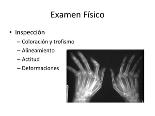 Examen Físico Inspección Coloración y trofismo Alineamiento Actitud Deformaciones 
