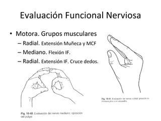 Evaluación Funcional Nerviosa Motora. Grupos musculares Radial.  Extensión Muñeca y MCF Mediano.  Flexión IF. Radial.  Extensión IF. Cruce dedos. 