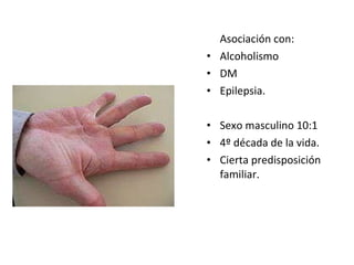 Asociación con: Alcoholismo DM Epilepsia. Sexo masculino 10:1 4º década de la vida. Cierta predisposición familiar. 