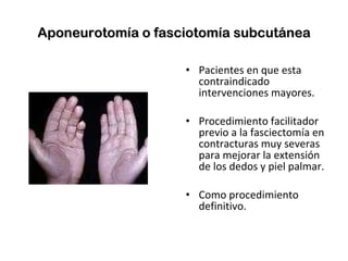 Aponeurotomía o fasciotomía subcutánea Pacientes en que esta contraindicado intervenciones mayores. Procedimiento facilitador previo a la fasciectomía en contracturas muy severas para mejorar la extensión de los dedos y piel palmar. Como procedimiento definitivo. 