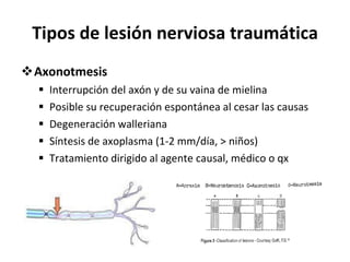 Tipos de lesión nerviosa traumática Axonotmesis Interrupción del axón y de su vaina de mielina Posible su recuperación espontánea al cesar las causas Degeneración walleriana Síntesis de axoplasma (1-2 mm/día, > niños) Tratamiento dirigido al agente causal, médico o qx 