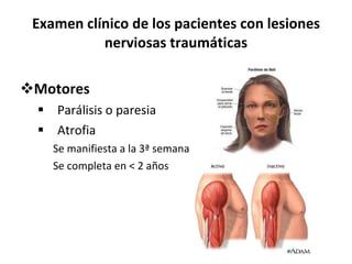 Examen clínico de los pacientes con lesiones nerviosas traumáticas Motores Parálisis o paresia Atrofia Se manifiesta a la 3ª semana Se completa en < 2 años 