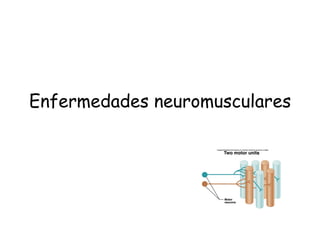 Enfermedades neuromusculares 