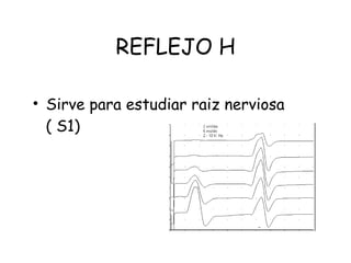 REFLEJO H Sirve para estudiar raiz nerviosa  ( S1) 