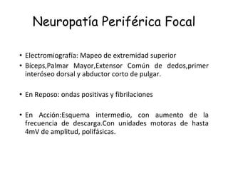Neuropatía Periférica Focal Electromiografía: Mapeo de extremidad superior Bíceps,Palmar Mayor,Extensor Común de dedos,primer interóseo dorsal y abductor corto de pulgar. En Reposo: ondas positivas y fibrilaciones En Acción:Esquema intermedio, con aumento de la frecuencia de descarga.Con unidades motoras de hasta 4mV de amplitud, polifásicas. 