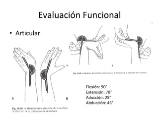 Evaluación Funcional Articular Flexión: 90° Extensión: 70° Aducción: 25° Abducción: 45° 