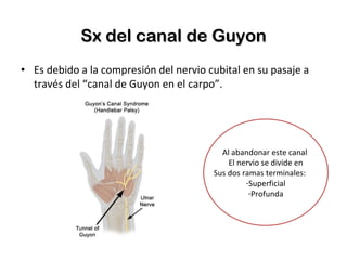 Sx del canal de Guyon Es debido a la compresión del nervio cubital en su pasaje a través del “canal de Guyon en el carpo”. Al abandonar este canal  El nervio se divide en Sus dos ramas terminales: Superficial Profunda 