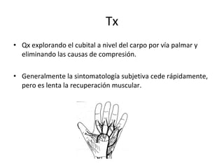Tx Qx explorando el cubital a nivel del carpo por vía palmar y eliminando las causas de compresión. Generalmente la sintomatología subjetiva cede rápidamente, pero es lenta la recuperación muscular. 