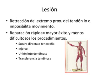 Lesión  Retracción del extremo prox. del tendón lo q imposibilita movimiento.  Reparación rápida= mayor éxito y menos dificultosos los procedimientos.  Sutura directa o tenorrafia Injerto Unión intertendinosa Transferencia tendinosa 