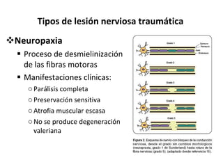 Tipos de lesión nerviosa traumática Neuropaxia Proceso de desmielinización de las fibras motoras Manifestaciones clínicas: Parálisis completa Preservación sensitiva Atrofia muscular escasa No se produce degeneración valeriana 