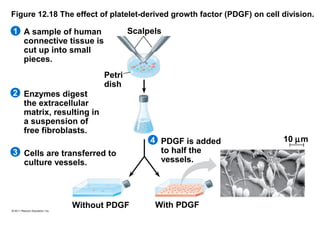 Figure 12.18 The effect of platelet-derived growth factor (PDGF) on cell division.

Scalpels

1 A sample of human
connective tissue is
cut up into small
pieces.

2 Enzymes digest
the extracellular
matrix, resulting in
a suspension of
free fibroblasts.

Petri
dish

3 Cells are transferred to
culture vessels.

Without PDGF

4 PDGF is added
to half the
vessels.

With PDGF

10 µm

 