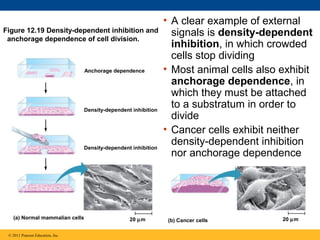 Figure 12.19 Density-dependent inhibition and
anchorage dependence of cell division.

Anchorage dependence

Density-dependent inhibition

Density-dependent inhibition

(a) Normal mammalian cells
© 2011 Pearson Education, Inc.

20 µm

• A clear example of external
signals is density-dependent
inhibition, in which crowded
cells stop dividing
• Most animal cells also exhibit
anchorage dependence, in
which they must be attached
to a substratum in order to
divide
• Cancer cells exhibit neither
density-dependent inhibition
nor anchorage dependence

(b) Cancer cells

20 µm

 