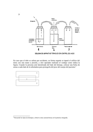 3




En caso que el tubo se saliera por accidente, en forma urgente se tapará el orificio del
tórax con una mano a presión, y otro operador realizará el vendaje como indica la
figura. Cuando la persona está lateralizada del lado del drenaje, colocar una bolsa de
arena a cada lado de la tubuladura para protegerla del peso del cuerpo del paciente.6


                                        3


                       1

                                        2




6
    Recuerde los tipos de drenajes y observe estas características en la práctica integrada.
 