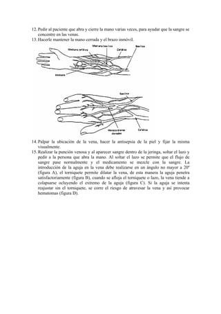 12. Pedir al paciente que abra y cierre la mano varias veces, para ayudar que la sangre se
    concentre en las venas.
13. Hacerle mantener la mano cerrada y el brazo inmóvil.




14. Palpar la ubicación de la vena, hacer la antisepsia de la piel y fijar la misma
    visualmente.
15. Realizar la punción venosa y al aparecer sangre dentro de la jeringa, soltar el lazo y
    pedir a la persona que abra la mano. Al soltar el lazo se permite que el flujo de
    sangre pase normalmente y el medicamento se mezcle con la sangre. La
    introducción de la aguja en la vena debe realizarse en un ángulo no mayor a 20º
    (figura A), el torniquete permite dilatar la vena, de esta manera la aguja penetra
    satisfactoriamente (figura B), cuando se afloja el torniquete o lazo, la vena tiende a
    colapsarse ocluyendo el extremo de la aguja (figura C). Si la aguja se intenta
    reajustar sin el torniquete, se corre el riesgo de atravesar la vena y así provocar
    hematomas (figura D).
 