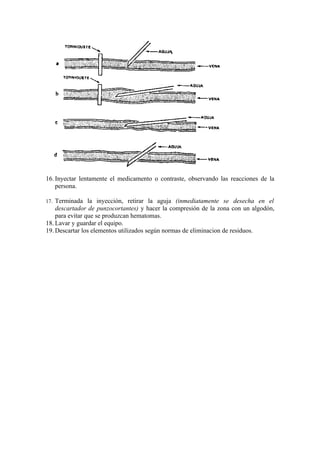16. Inyectar lentamente el medicamento o contraste, observando las reacciones de la
    persona.

17. Terminada la inyección, retirar la aguja (inmediatamente se desecha en el
    descartador de punzocortantes) y hacer la compresión de la zona con un algodón,
    para evitar que se produzcan hematomas.
18. Lavar y guardar el equipo.
19. Descartar los elementos utilizados según normas de eliminacion de residuos.
 