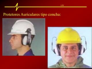 LAV
Protetores Auriculares tipo concha:
 