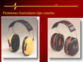 LAV
Protetores Auriculares tipo concha:
 