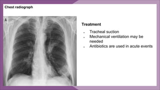 Chest radiograph
Treatment
● Tracheal suction
● Mechanical ventilation may be
needed
● Antibiotics are used in acute events
 