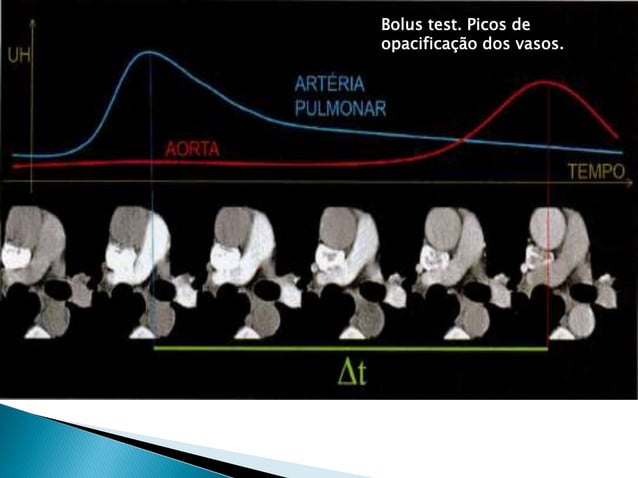 ACap 2 tc torax tecnicas e protocolos ( cap2) | PPT