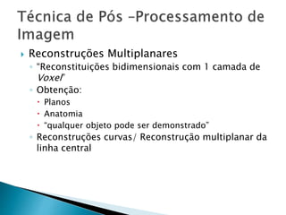 ACap 2 tc torax tecnicas e protocolos ( cap2) | PPTX